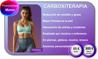 Carboxiterapia